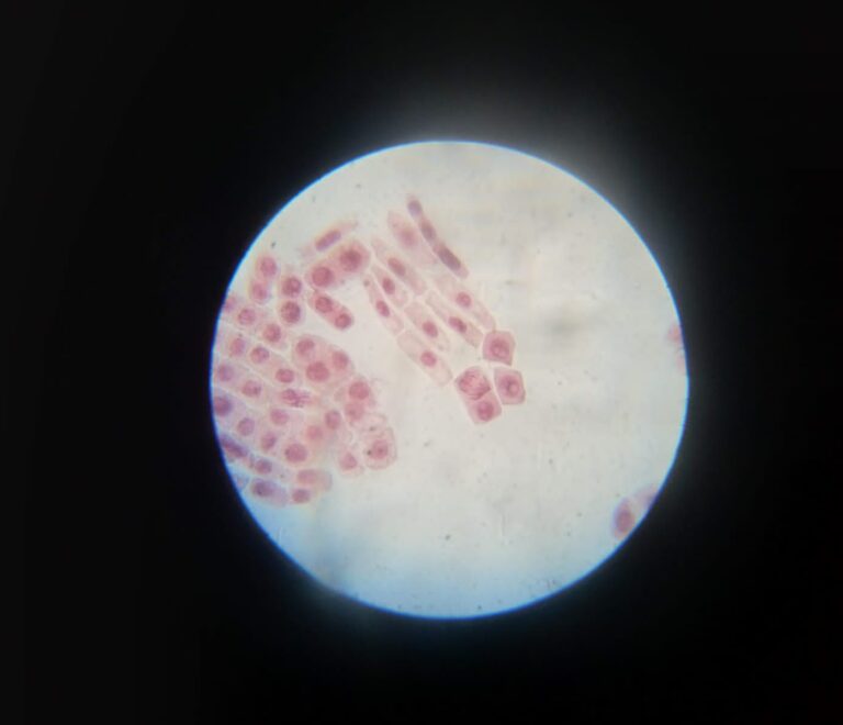 Mitotic phases in onion root tips
